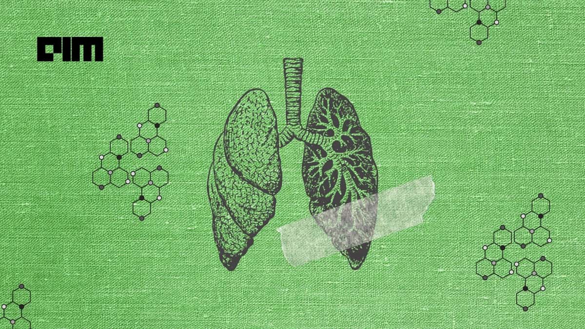 Interview with developers of Swaasa, an AI platform to diagnose lung diseases