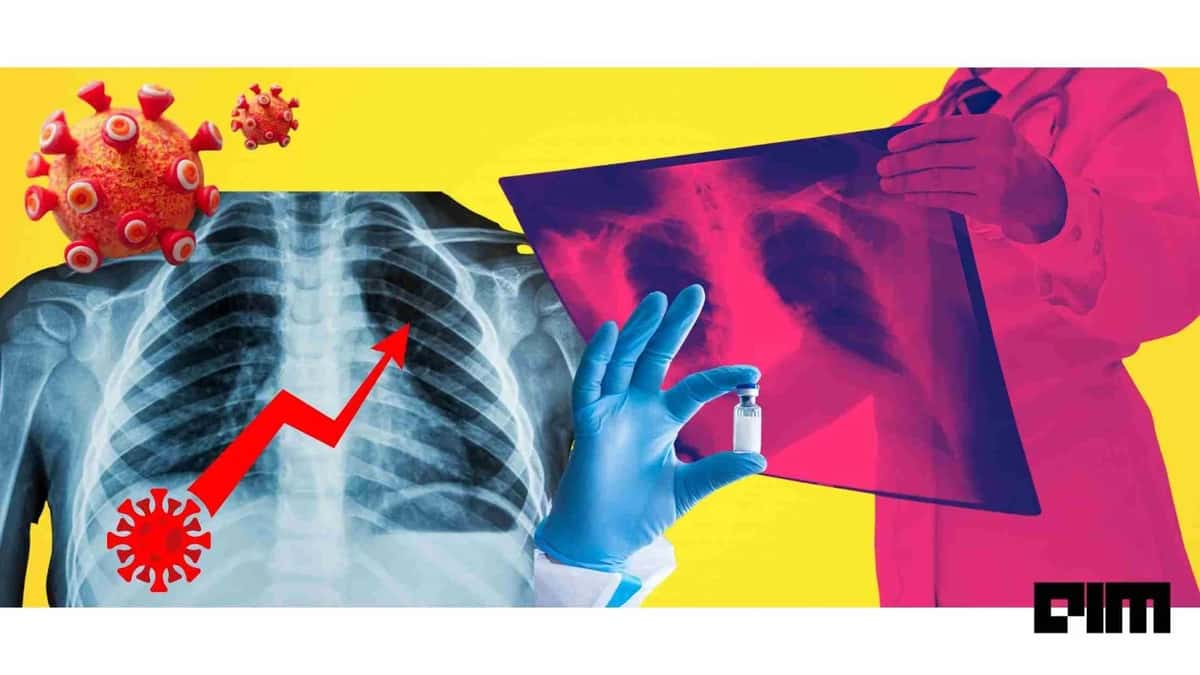 How XRay Setu Diagnoses COVID-19 In 15 Minutes