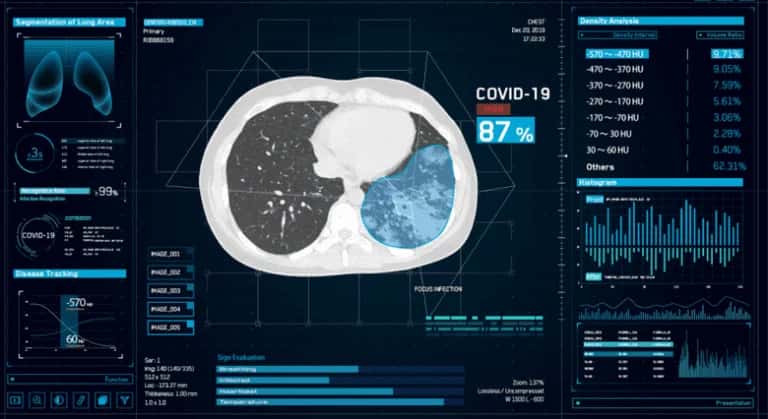 Will Scan Based AI Systems Be Useful In Diagnosis For COVID-19?