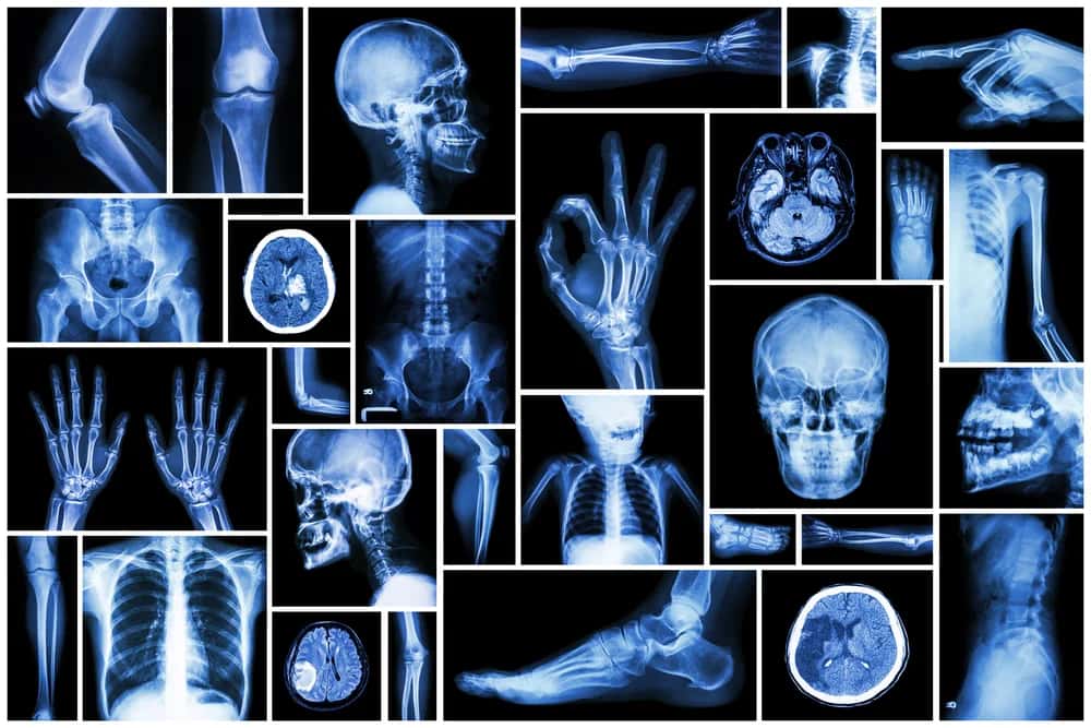 Understanding Transfer Learning For Medical Applications