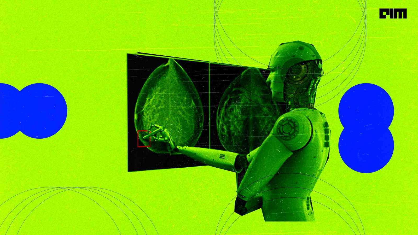 Chinese university develops AI tool to detect early-stage lung cancer