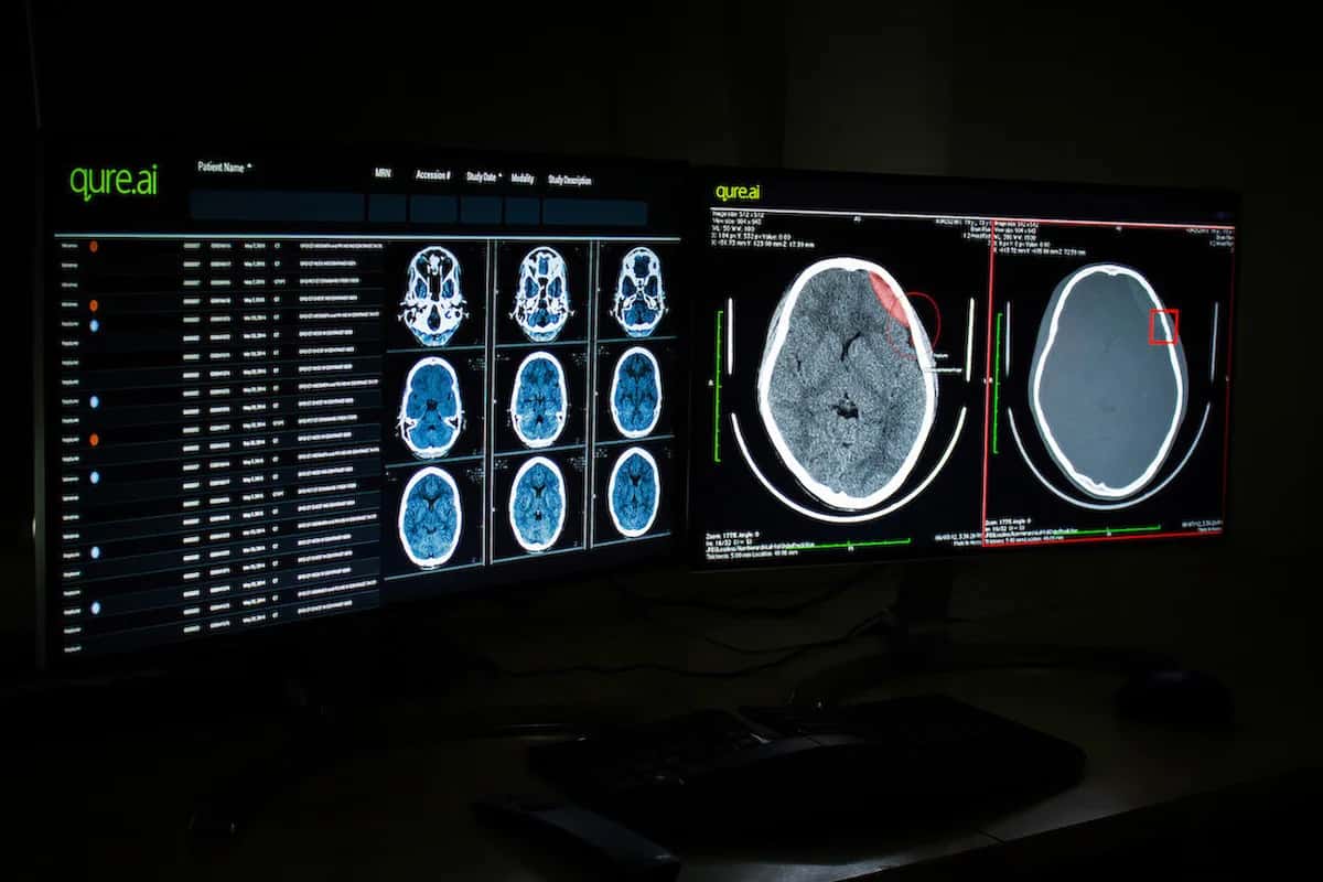 Qure.ai Develops AI-Powered Solutions To Flatten The Curve On Covid-19