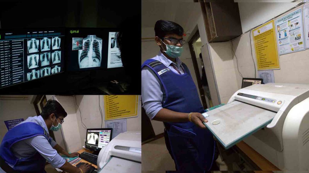 How Deep Learning Is Used For Tuberculosis Detection In City Of Nagpur