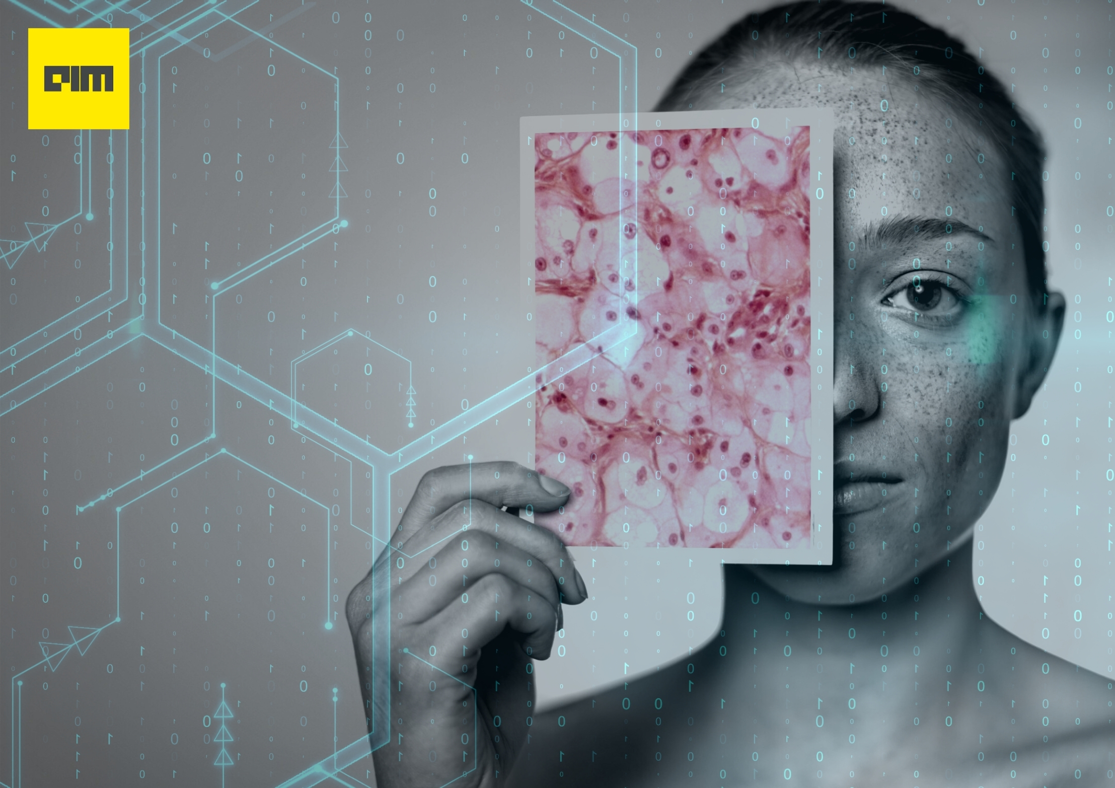 MIT Researchers Develop An AI Tool To Detect Skin Cancer